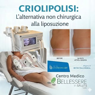 🌿 Ami il tuo corpo, preparalo per l’estate con BELLESSERE. 🌸☀️
La stagione calda è alle porte e tu