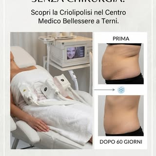 🔬 **Rimodella il tuo corpo senza chirurgia! Scopri la Criolipolisi nel Centro Medico Bellessere a T