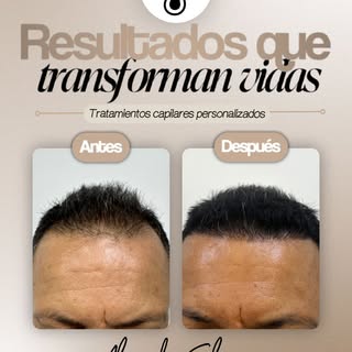 No se trata solo de recuperar cabello. ✨

Se trata de diseñar una línea capilar que respete tus facc