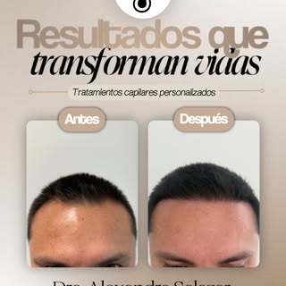 Un cambio que va mucho más allá del cabello. ✨

Recuperar densidad también puede transformar la form