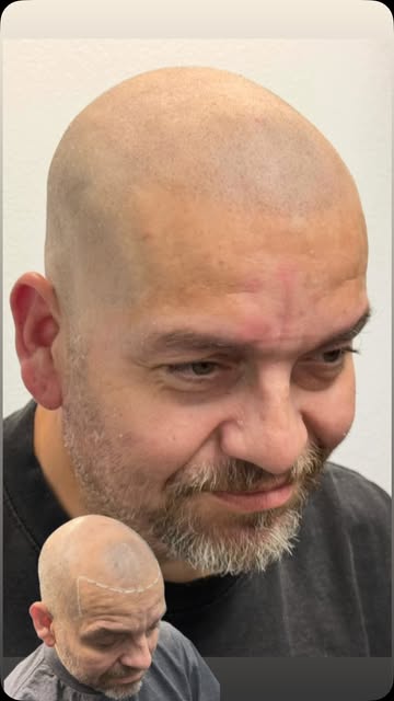 Are you ready to stop covering up thinning hair and start investing in a look that feels polished, c