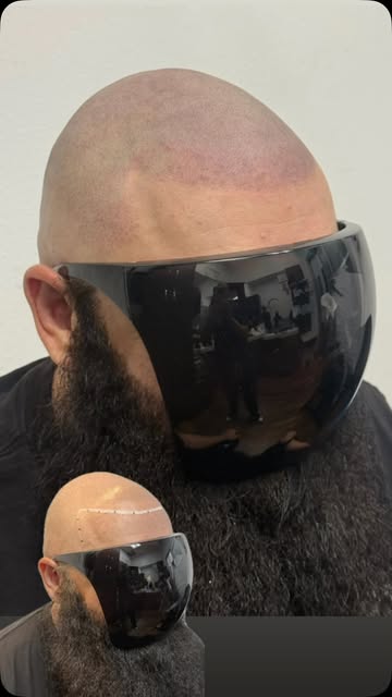 What if your next level of confidence started with your hairline? 🔥 Stop hiding thinning areas, rec