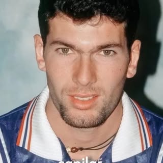 El caso de calvicie de Zinedine Zidane.