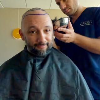 Sí, me puse pelo. 💇🏻‍♂️ Y si algo aprendí en este proceso es que la mano del cirujano importa much