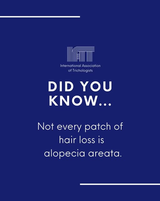 Patchy hair loss is often associated with alopecia areata, but it's not the only possible diagnosis.
