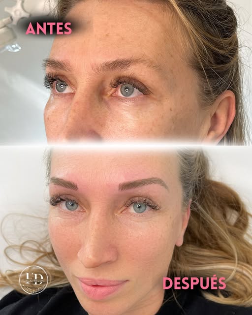 ✨ Antes y después: el poder de unas cejas bien diseñadas. 

No se trata solo de cambiar la forma o e