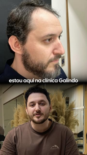 Quando o resultado começa a ficar melhor do que aquilo que você imaginava antes da cirurgia, a compa