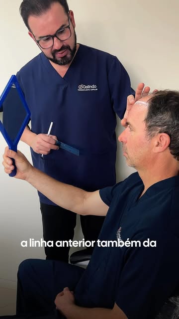 Nem toda área de calvície precisa receber a mesma quantidade de fios, e existe uma razão para isso.
