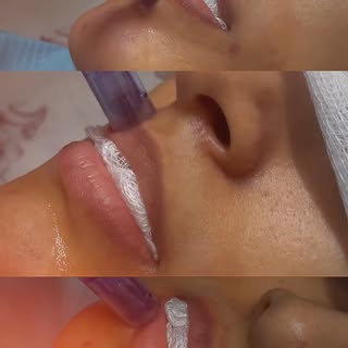 Lip brightening: Giving your lips the spotlight they deserve.

📞 042 32364453
📱 +92 333 8978978 | 