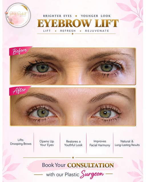 ✨ Eyebrow Lift for a Brighter, Younger Look!

Lift drooping brows, open up your eyes & refresh your 