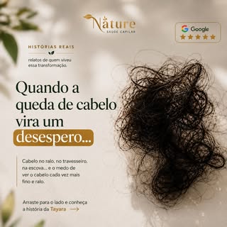 Quando a queda de cabelo vira um desespero, não é só o cabelo que sofre. A autoestima e a esperança 