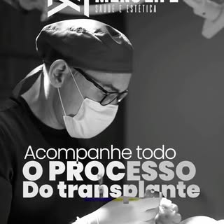 Hoje abrimos as portas para mostrar todo o procedimento de transplante capilar, de forma clara, tran
