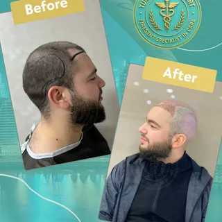 From thinning to confidence 🔥
One decision. One transformation. Real results.
This is not a filter.