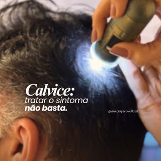 Tratar queda e afinamento exige mais do que apostar em uma única solução.

O mais importante é enten