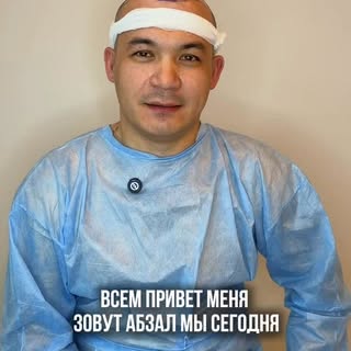 Очередной кейс.

Пациент Абзал обратился с запросом на коррекцию передней линии роста волос и зоны м