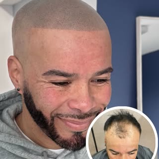 Another satisfied client he is enjoying his new look. Invest in yourself ❗️ schedule your free consu