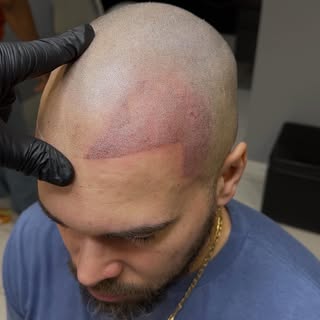 Getting the hairline on point…👈🏼 Schedule you free with no obligation consultation at 717-333-7281