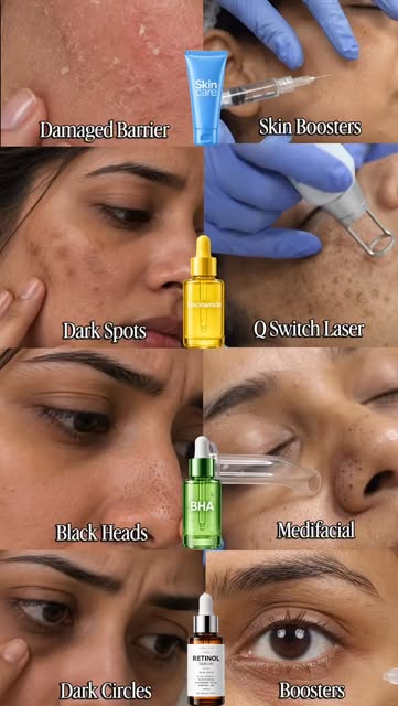 Clearer-looking skin starts with the right care. 💚

BHA helps gently exfoliate, unclog pores and su