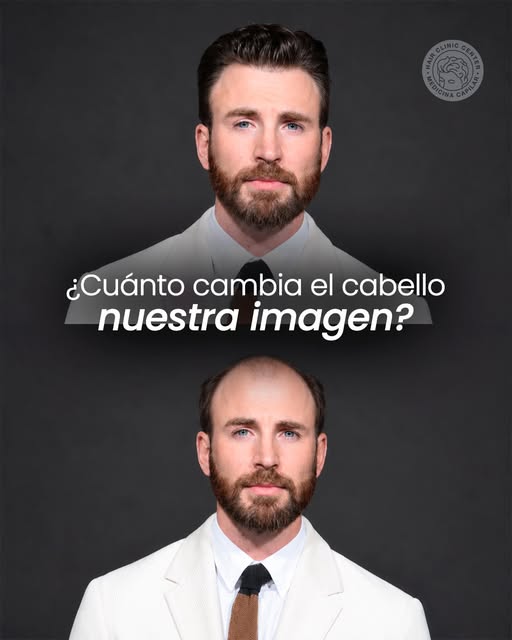 El cabello no cambia quién sos, pero sí puede cambiar la forma en la que te ves y, muchas veces, cóm