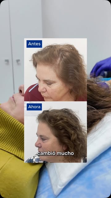 A veces, el primer paso es entender qué está pasando con tu cabello.💙

Inés llegó a Hair Clinic Cen