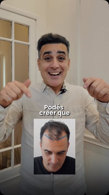 ¿Podes creer este resultado?✨

Ramiro decidió dar el paso y hoy el cambio es increíble. Su implante 