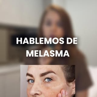 Todo lo que tienes que tener en cuenta sobre el melasma este verano

El sol, el calor y nuestros háb