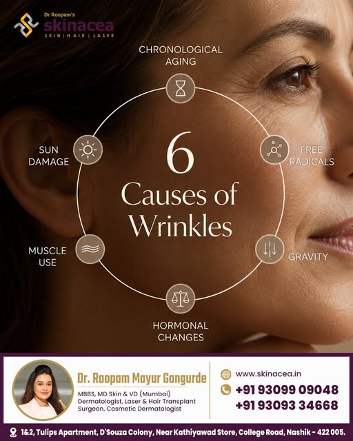 Wrinkles aren’t caused by age alone. 👀

Sun exposure, repeated facial movements, hormonal changes, 