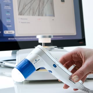 🔬 Kamera KC Scopes – precyzja, w konsultacji trychologicznej!

Nowoczesna diagnostyka to podstawa s