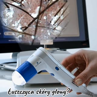 Łuszczyca skóry głowy ☝️

Problem, który wymaga odpowiedniego wsparcia zarówno pod względem suplemen