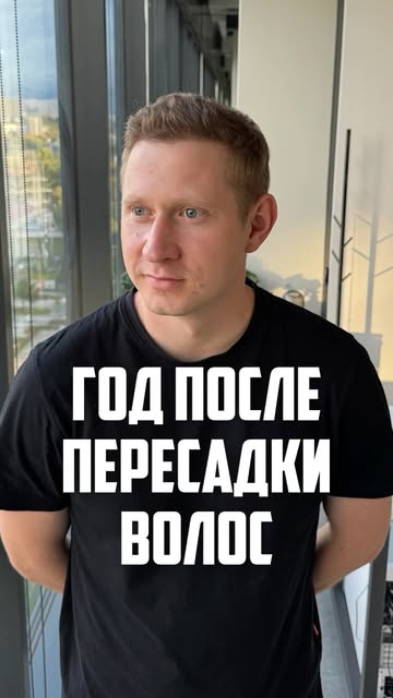 @s.g.bircan - доктор @the_fagan - по всем вопросам #пересадкаволос #турция #егорконанов #анестезиоло