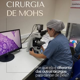 Quando a gente fala em retirar um câncer de pele, muita gente imagina que todas as cirurgias são igu
