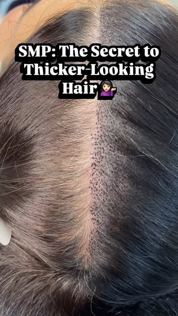💖 Ladies, struggling with thinning hair? 💇🏻‍♀️ SMP can help! 💁🏻‍♀️

✨ 3 sessions
⏳ 3–4 hours ea