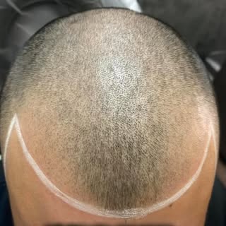 Confidence looks different on everyone—but this right here? 🔥✨
A clean, natural hairline that bring