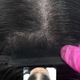 SMP DENSITY CAN MAKE A HUGE DIFFERENCE 🔥🖤

This treatment helps create the appearance of fuller, d