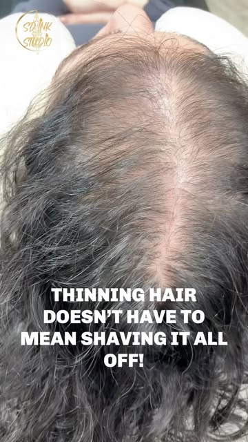 Thinning hair? 👀 Take a look at this SMP density transformation after just ONE session! 🔥

SMP can