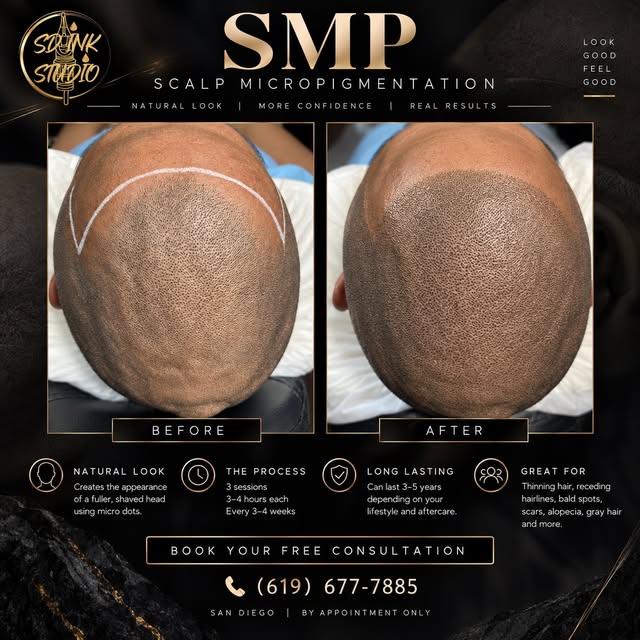 Ready for a new hairline? 🔥

Scalp Micropigmentation (SMP) creates the appearance of natural hair f