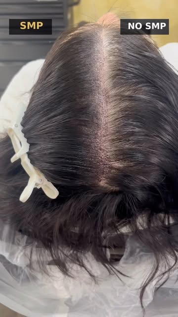 THINNING HAIR? 👀 You have options! 🔥

SMP helps create the look of fuller, thicker hair by adding 