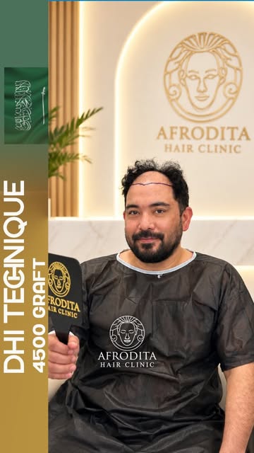 Meet the absolute best in hair restoration! 

As Afrodita Hair Clinic in Sisli, Istanbul, we set the