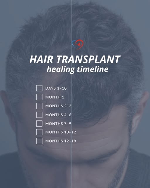 Patience is your absolute best tool after getting a hair transplant. Restoration doesn’t happen over