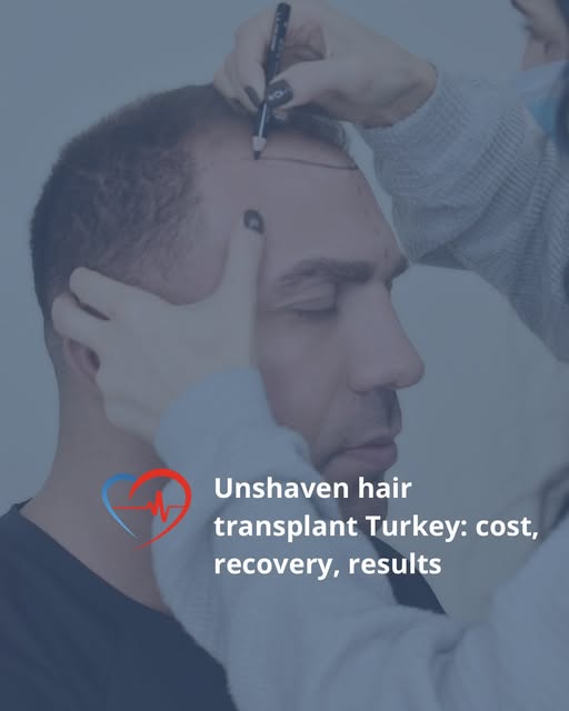 The biggest hesitation for many considering hair restoration is the thought of shaving their head co
