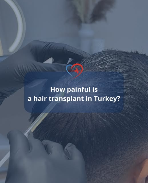 The #1 fear before a hair transplant: «What if it hurts?» 🫣

Spoiler alert: no, it doesn’t hurt at 