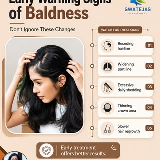 ⚠️ Early Warning Signs of Baldness – Don’t Ignore These Changes

Hair loss often starts gradually, m