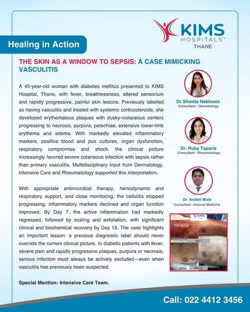 Healing in Action | The Skin as a Window to Sepsis

Not every skin rash is vasculitis. Sometimes, it