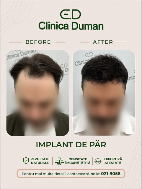 Îți dorești ca rezultatul final să fie pe măsura așteptărilor tale? Atunci evaluarea zonei donatoare
