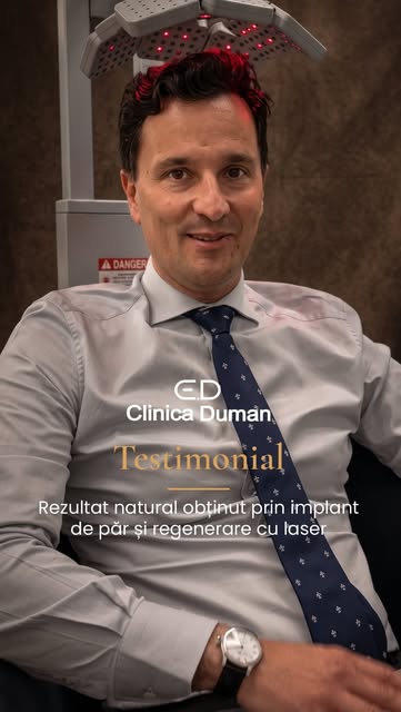 O experiență spusă chiar de pacient. 
Decizia de a face un implant de păr vine cu întrebări și aștep