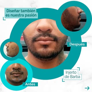 😀 Diseñar también es nuestra pasión! 👉 Si observas cada uno de nuestros trabajos, ya sea de barba 