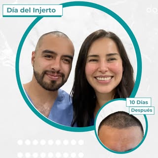 Hay momentos en los que no es solo el cabello lo que falta…
es la forma en la que nos mirábamos a no