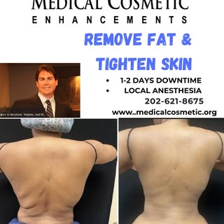 Free in office or virtual consultation available!

Visit our website at www.medicalcosmetic.org for 