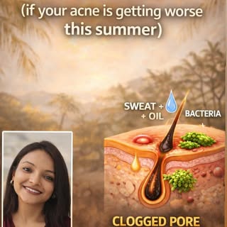 STOP THIS if your acne is getting worse this summer ☀️

Heat, sweat & excess oil create the perfect 