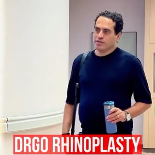 Our young female patient underwent a personalized rhinoplasty performed by Assoc. Prof. Dr. Guncel O